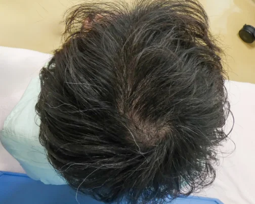 治療のビフォーアフター