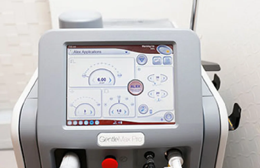 しみ取りレーザー治療