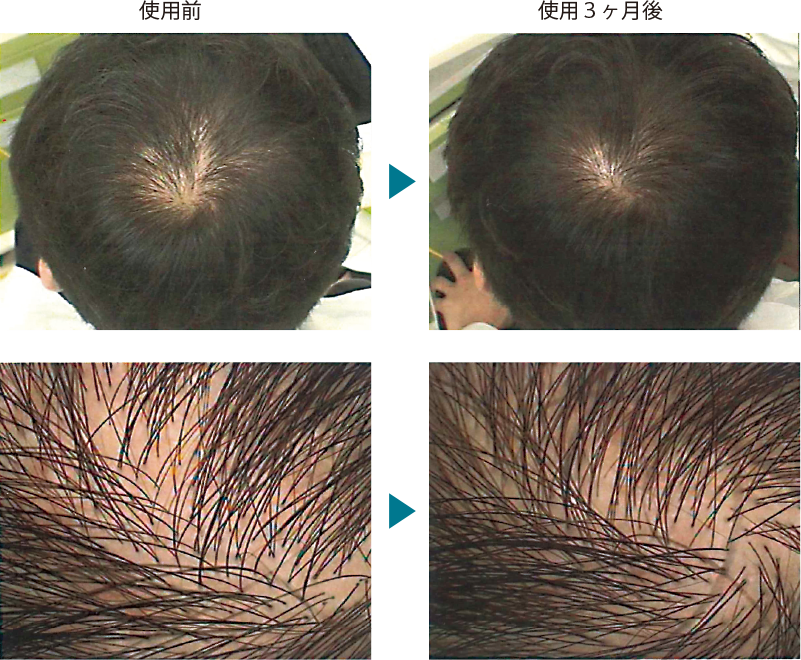 使用前後3ヶ月の比較